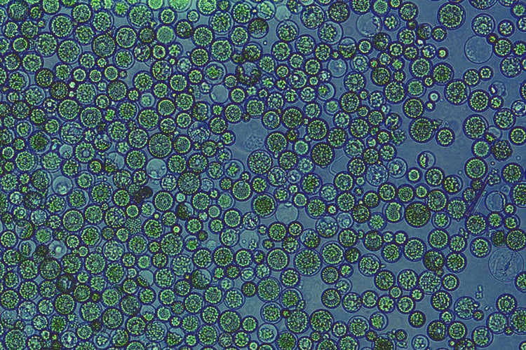 lots of green, circular leaf protoplasts
