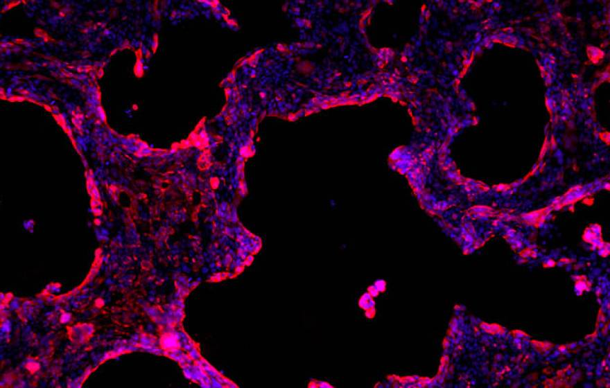 Human lung epithelial cells close up