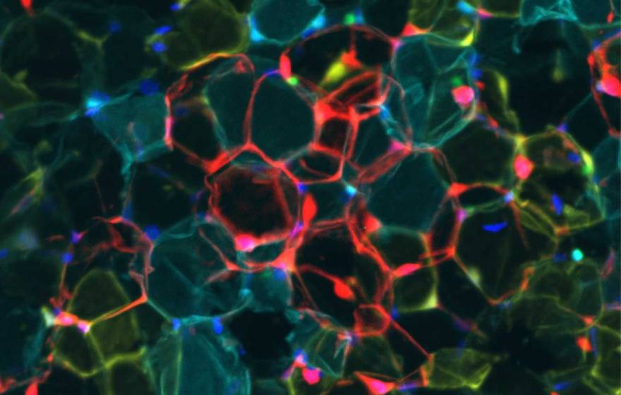 Calorie-storing white fat cells